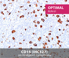 CD15 Staining Image