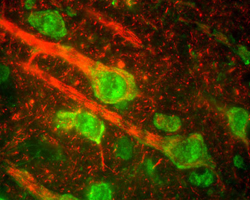rat cerebral cortex stained with rabbit polyclonal antibody to Neurofilament 