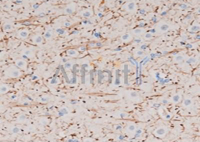 P2RY12 Antibody Staining image