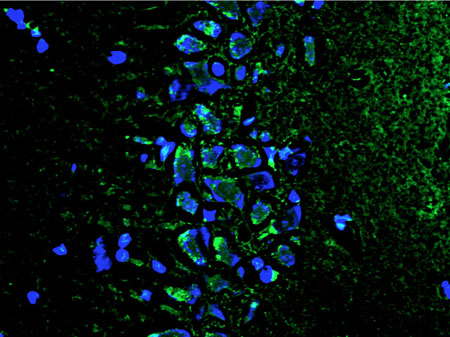 Staining of degenerating neurons in the CA3 region of the hippocampus in old diabetic rats. Stained with Fluoro-Jade C